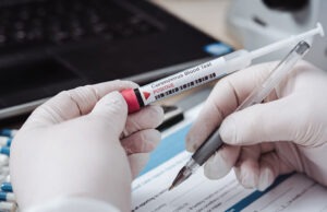 Test Sierologici vaccinazioni